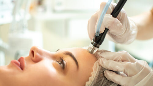 Hydrafacial-Gerät bei einer intensiven Gesichtsbehandlung zur Porenreinigung und Hautpflege