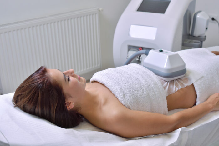 Junge Frau liegt entspannt auf einer Liege, während sie eine Cryolipolyse-Behandlung am Bauchbereich erhält. Das Behandlungsgerät ist auf dem Bauch fixiert.