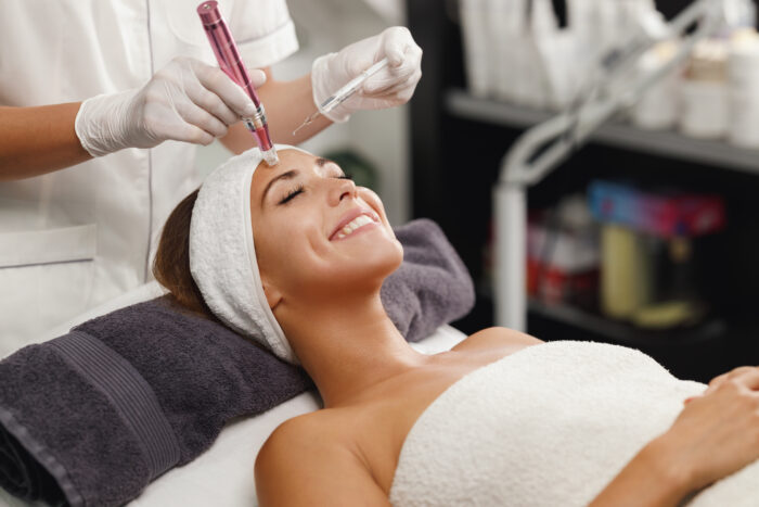 Eine lächelnde Frau liegt entspannt auf einer Liege und erhält eine professionelle Microneedling-Behandlung im Gesicht. Die Kosmetikerin führt das Microneedling-Gerät sorgfältig über die Stirnpartie.