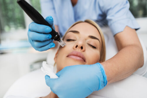 Frau erhält eine Microneedling-Behandlung mit einem elektrischen Dermapen, durchgeführt von einer Fachkraft mit blauen Handschuhen im Kosmetikinstitut