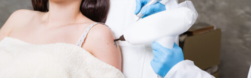 Entfernung von Permanent Make-up und Tattoos