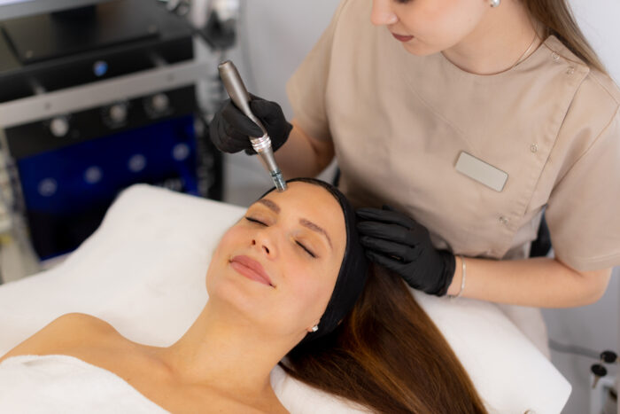 Microneedling mit Derma-Pen und Hyaluron Serum – Bild 2