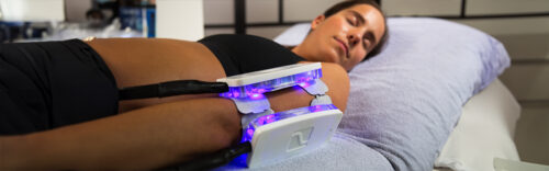 Kryolipolyse mit Muskelstimulation (EMS)