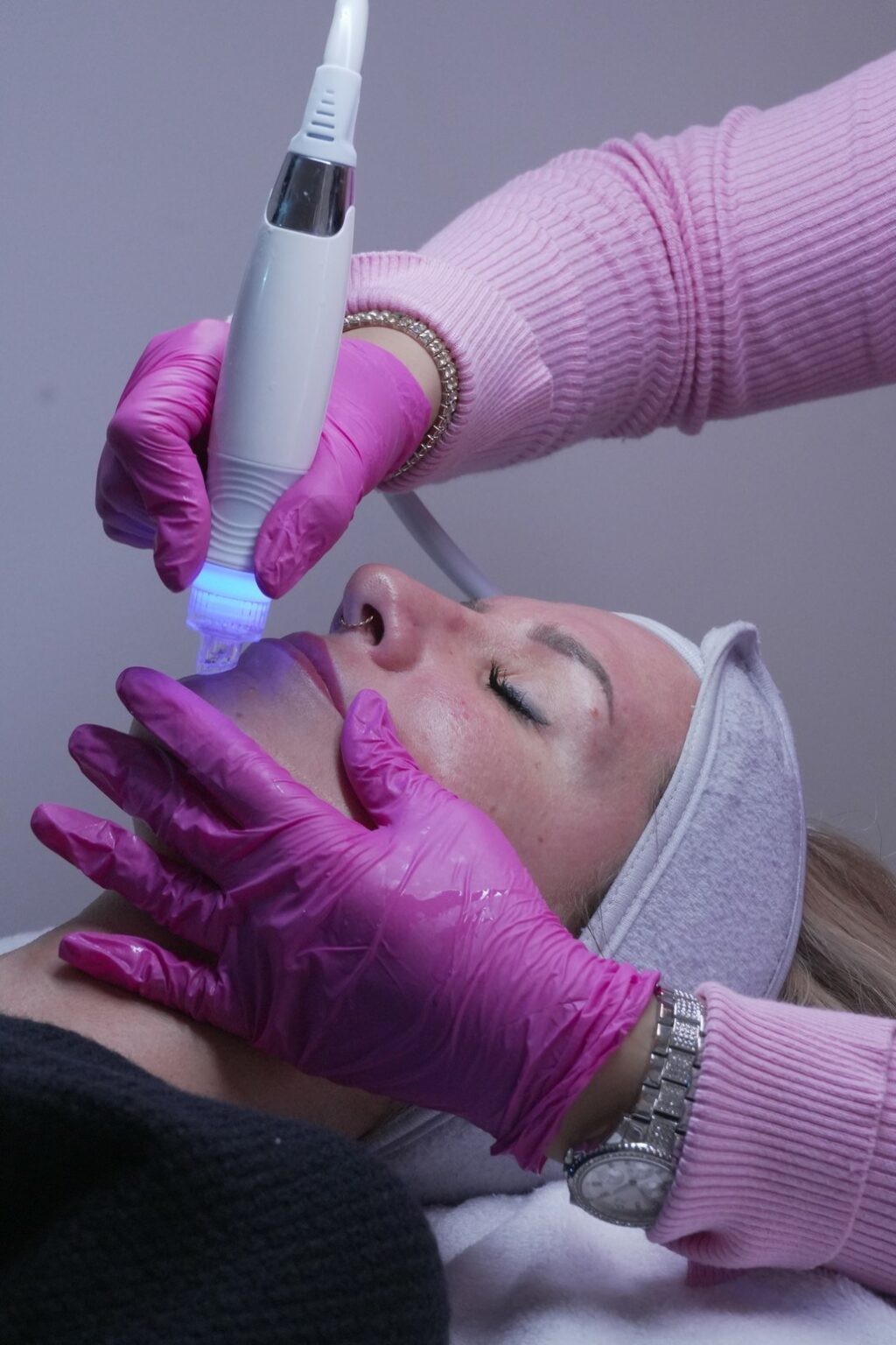 Aquafacial & Microneedling – Bild 2