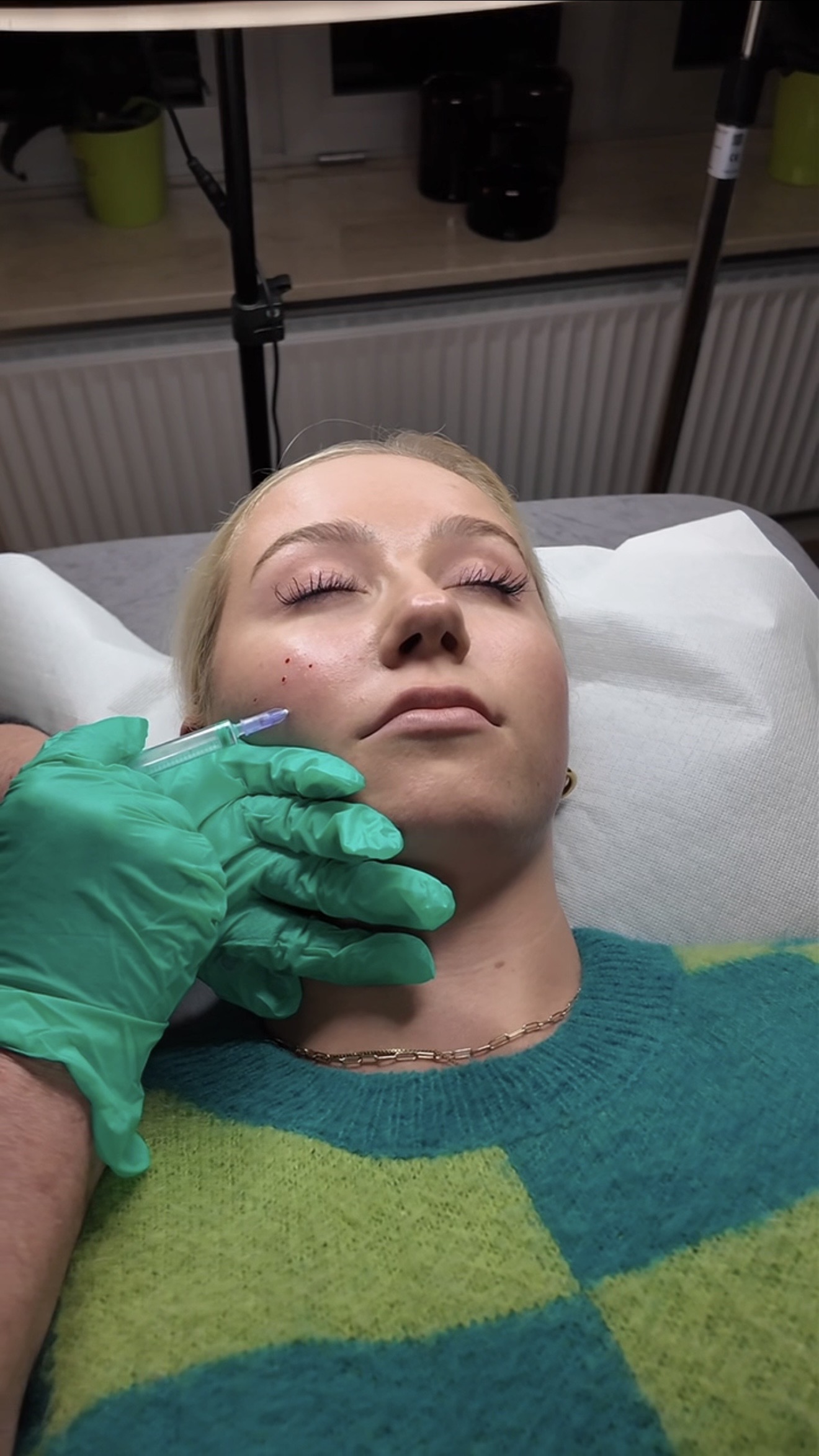 Hyaluron-Tiefenflutung für das gesamte Gesicht – Bild 3