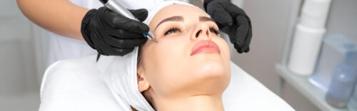 60 Min. Microneedling
