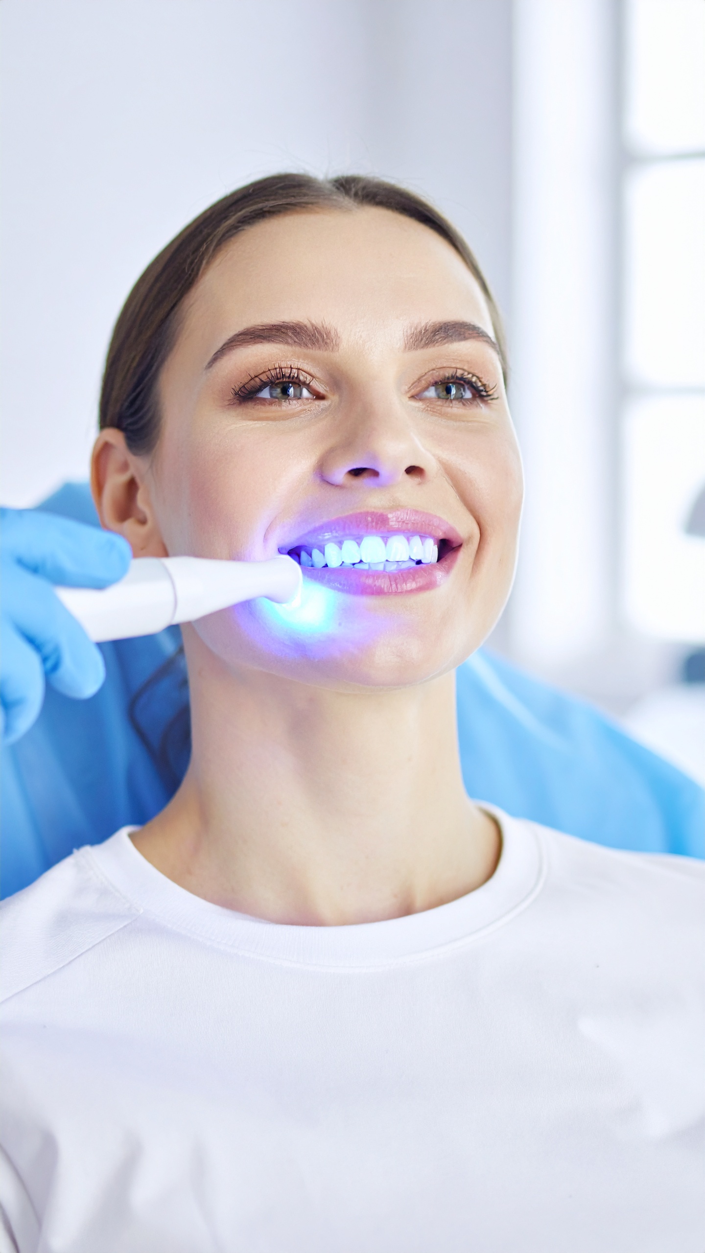 Zahnaufhellung & Zahnschmuck – Bild 3