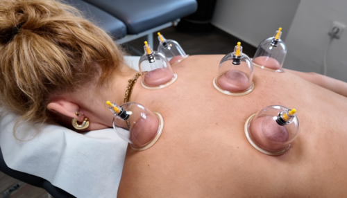 Akutschmerz-Intensivbehandlung bei Naturo Medicus Gelsenkirchen mit Schröpftherapie zur gezielten Schmerzbehandlung im Rückenbereich