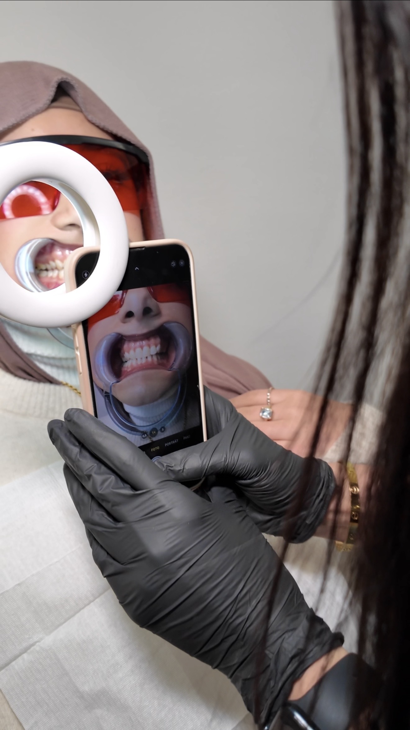 Kosmetisches Zahnbleaching – Bild 3