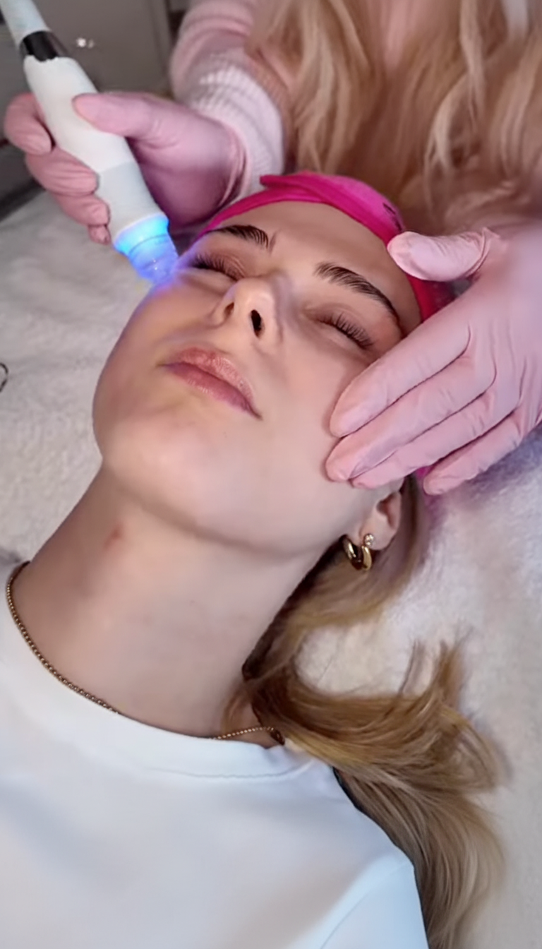 Aquafacial & Microneedling – Bild 3