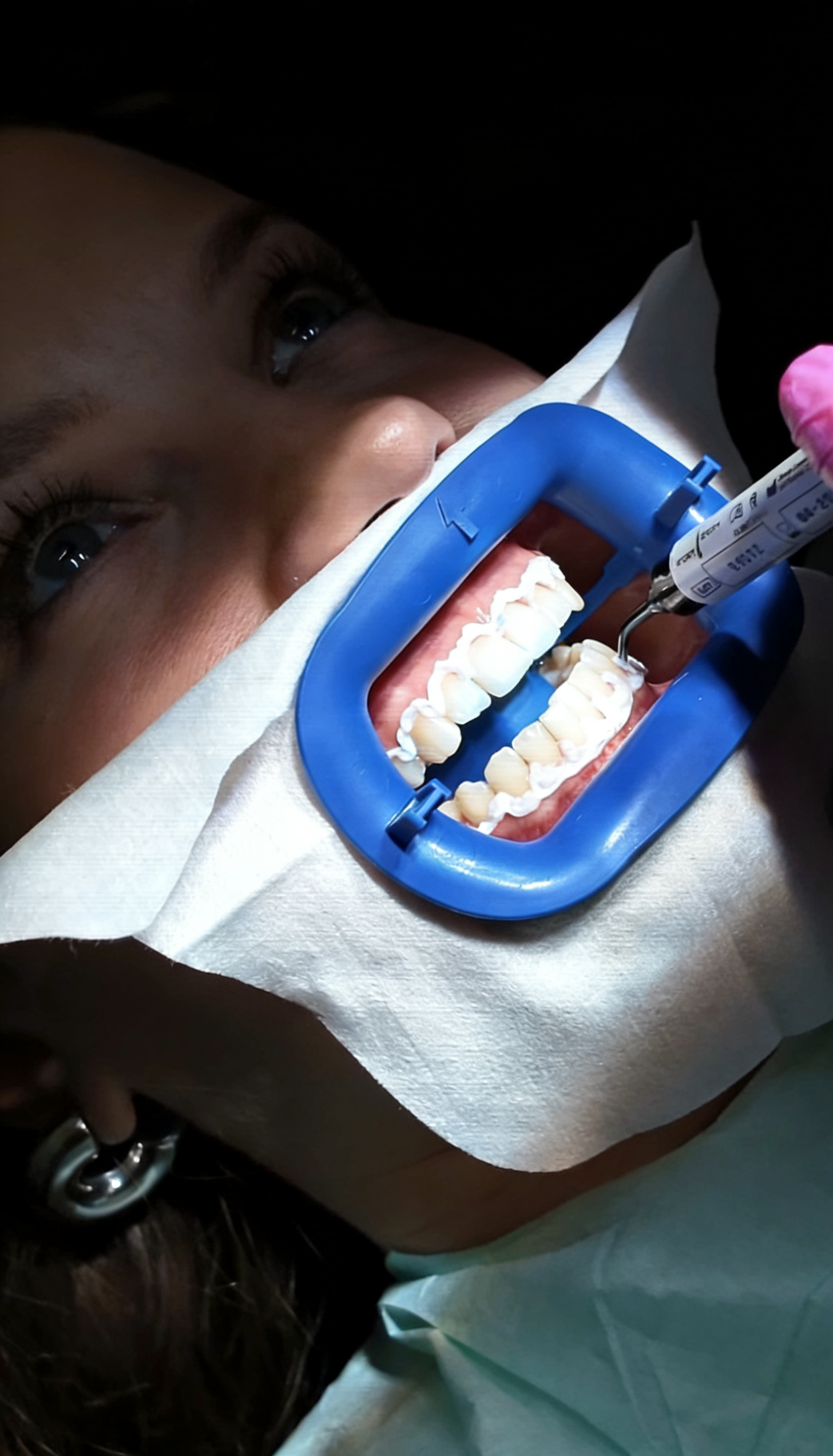 Wertgutschein für eine Zahnreinigung oder Zahn‑Bleaching – Bild 4