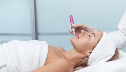Microneedling für Gesicht, Hals & Dekolleté