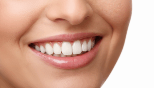 Kosmetische Zahnaufhellung