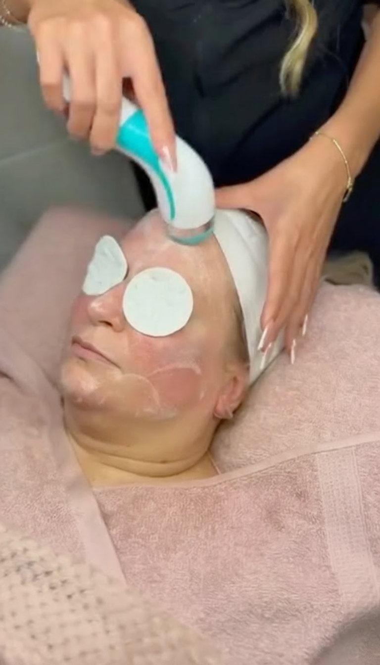 Aquafacial Behandlung – Bild 4