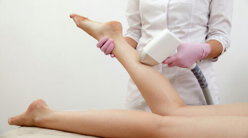 Diodenlaser‑Haarentfernung