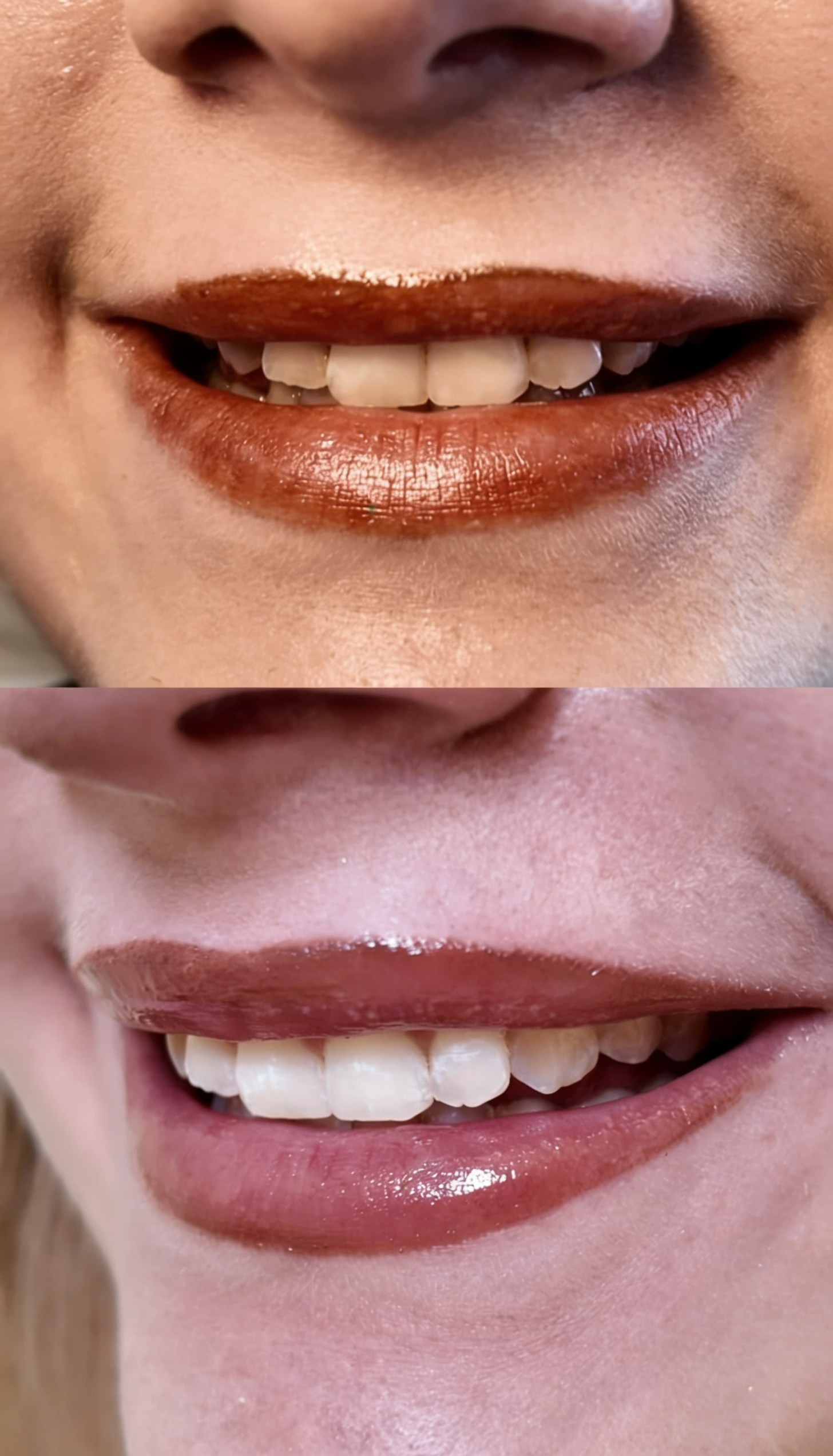 Vorher Nachher Vergleich eines Zahnbleachings bei Piercing Clicker Wiesbaden mit sichtbar aufgehellten Zähnen nach der Behandlung