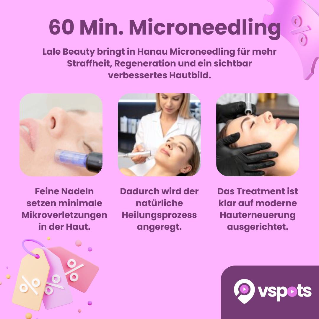 60 Min. Microneedling – Bild 5