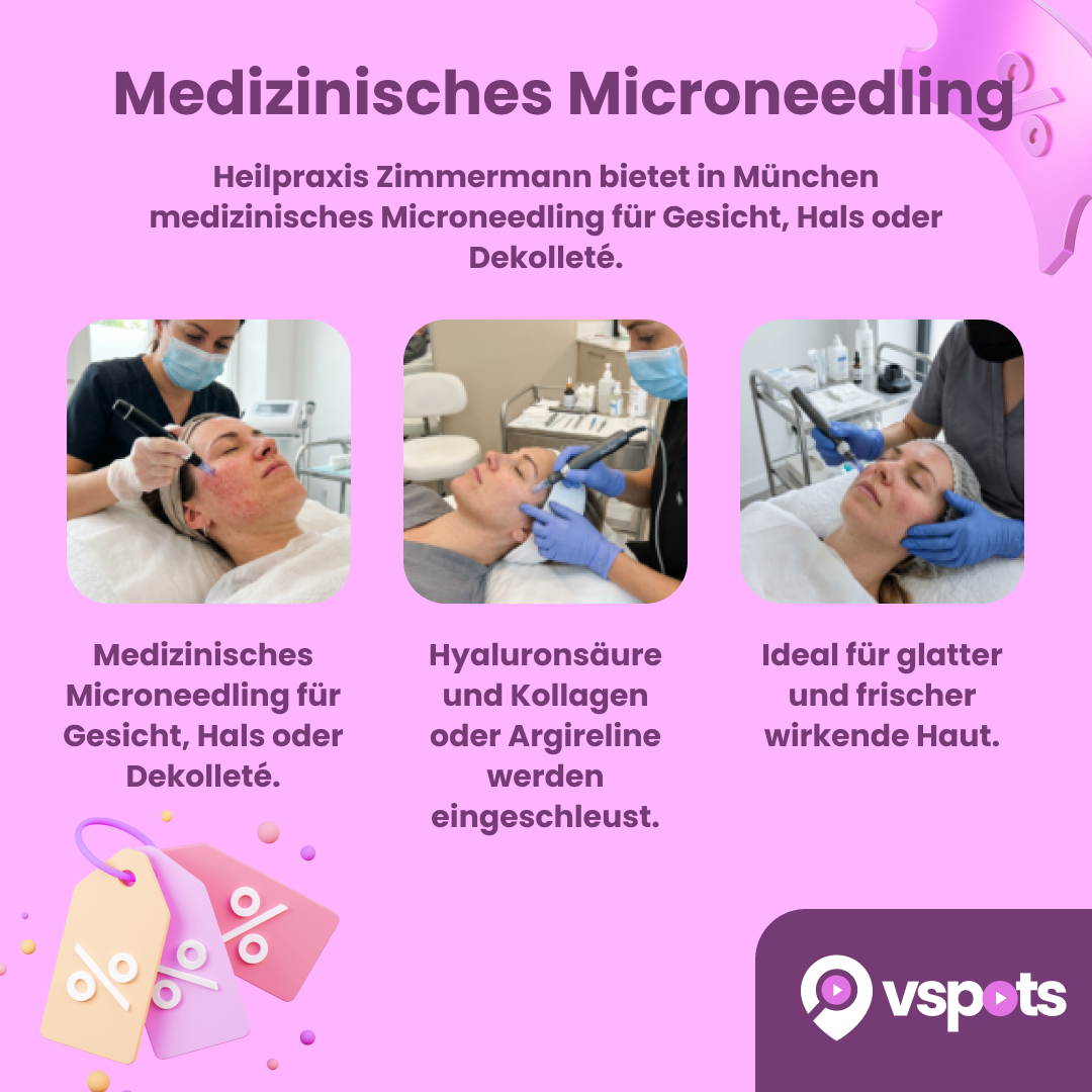 Medizinisches Microneedling – Bild 6