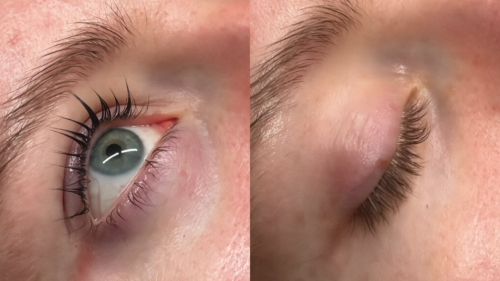 Korean Lashlifting