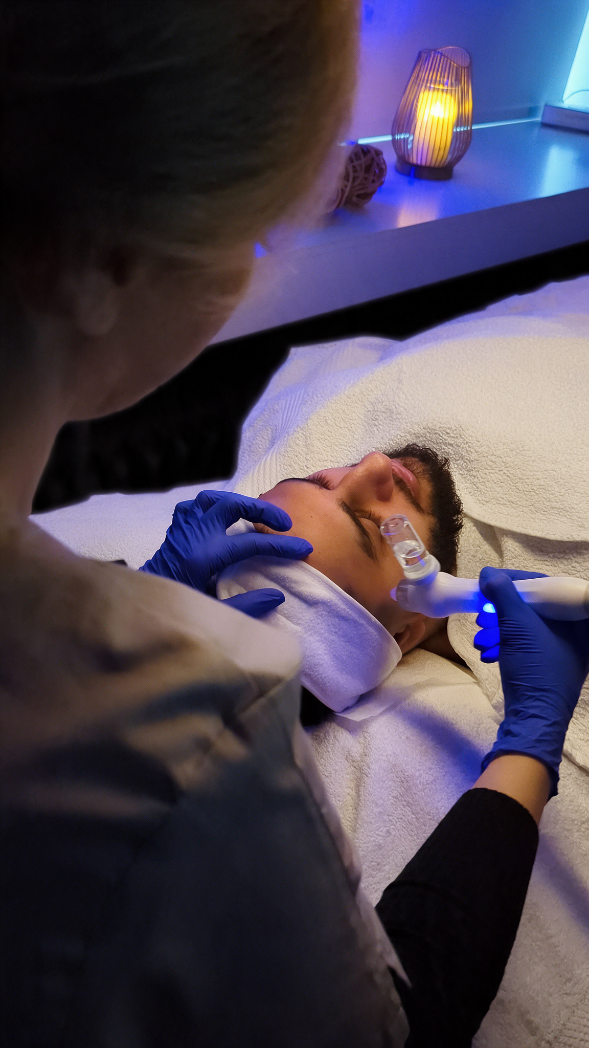Microneedling mit Lachs DNA – Bild 3